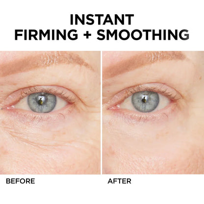 🚨𝑳𝑨𝑺𝑻 𝑫𝑨𝒀 𝑫𝑰𝑺𝑪𝑶𝑼𝑵𝑻: 𝟖𝟕% 𝑶𝑭𝑭 🔥 Instant Wrinkle Eye Tightener Cream