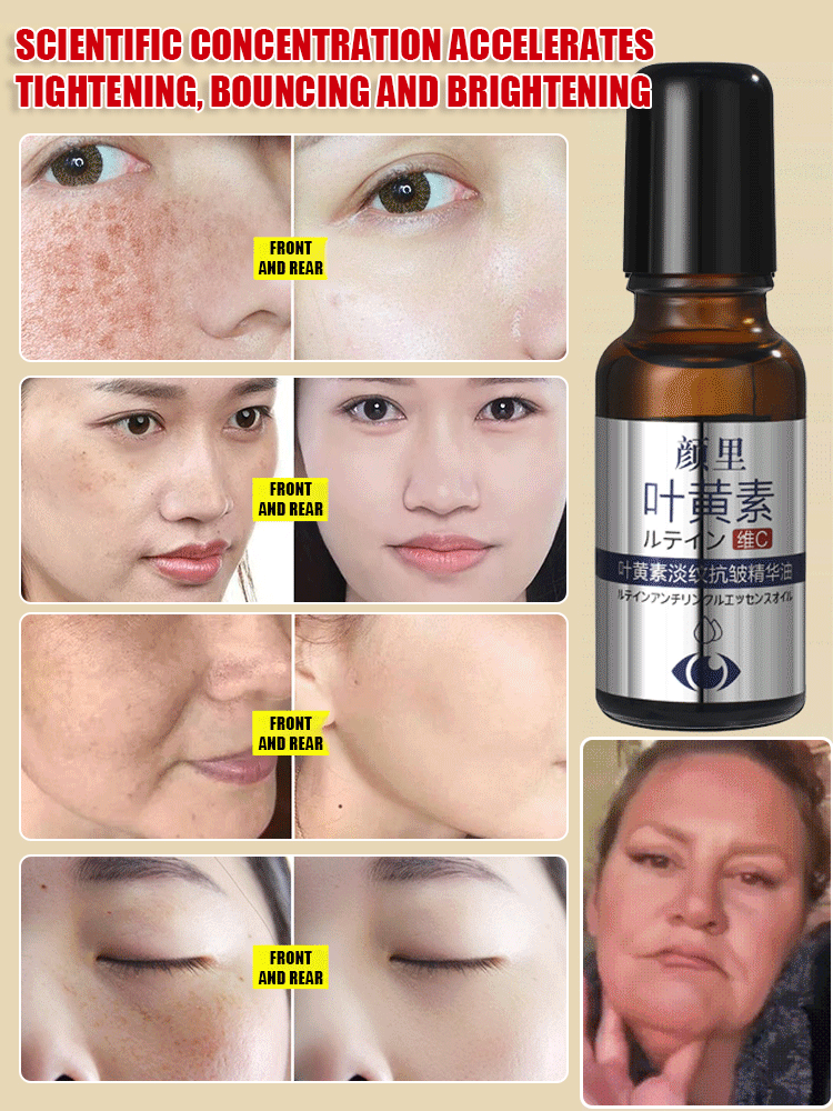 Lutein Anti Wrinkle Essence Oil