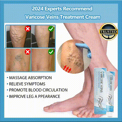 💥2024 Experts Recommend Product-Varicose Veins Treatment Cream
