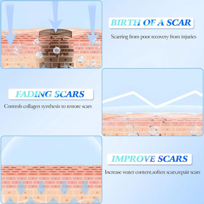 🔥Limited Time Offer🔥Skin Smoothing Scar Cream, Lighten & Repair All Scars