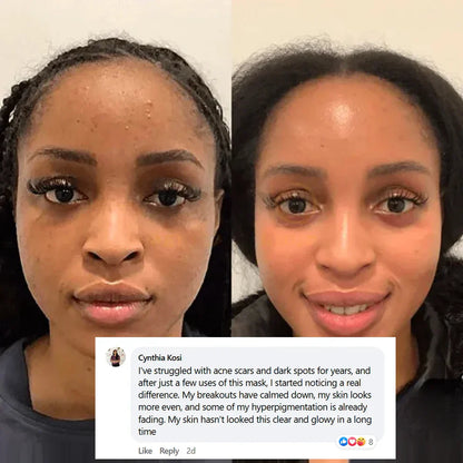 🏆Pamper Yourself —Collagen Night Wrapping Mask