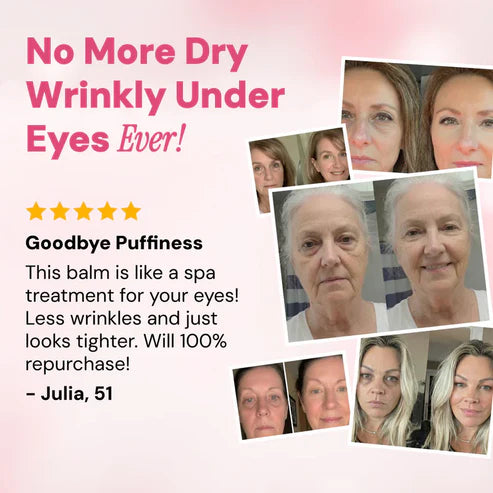 🏆Pamper Yourself🎁REVIVE TIRED EYES -HYDRATING & ANTI-WRINKLE EYE BALM