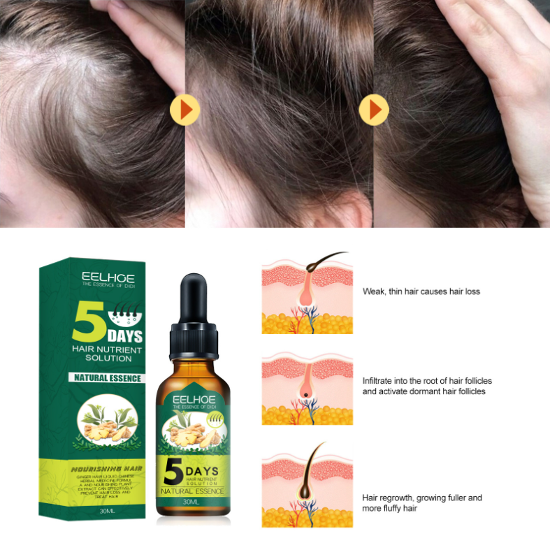 2021 New Ginger Hair Oil
