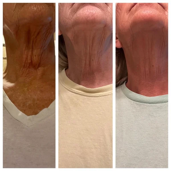 2024 NEW Tighten Lift Firming Neck Cream